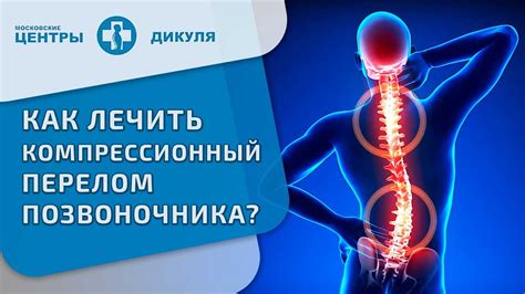 Перспективы восстановления подвижности после сломанного позвоночника