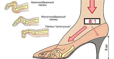 Польза низкого сезона