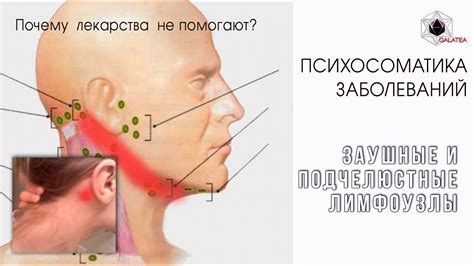 Последствия игнорирования боли в лимфоузлах