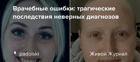 Последствия неверных ожиданий