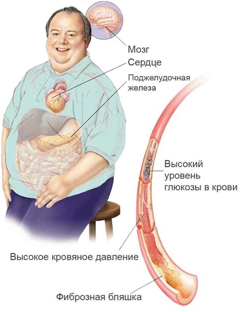 Последствия сахарного диабета