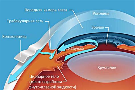 Появление шпиля внутри глаза