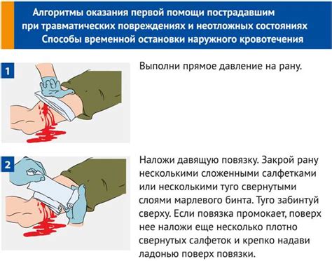 Преимущества давящих повязок сдо перед другими методами лечения