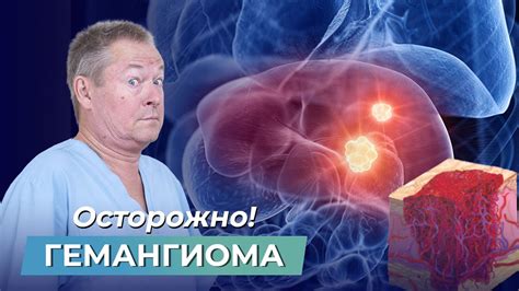 Преимущества и ограничения электрофореза при гемангиоме