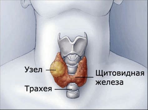 Признаки и методы определения увеличения щитовидной железы