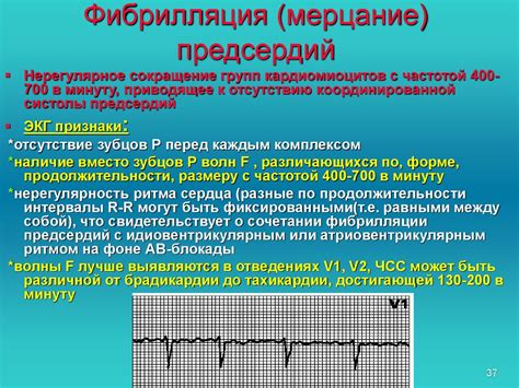 Применение предуктала при аритмии