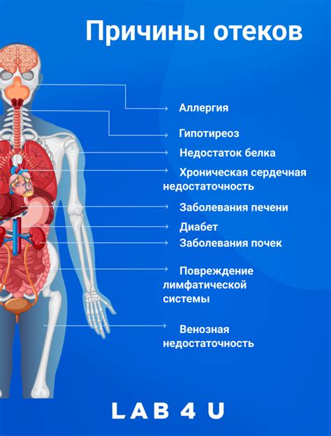 Причины возникновения отечности