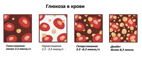 Причины низкого уровня глюкозы в крови