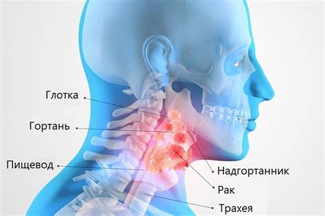 Причины першащего горла