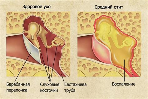 Причины появления отдачи в ухо при открытии рта