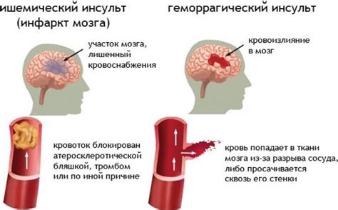 Причины проблемы и наиболее распространенные симптомы