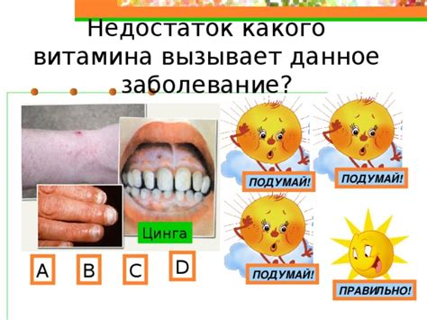 Проблема с хрустящими костями: недостаток какого витамина?