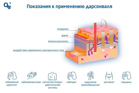 Профессиональные советы по применению дарсонваля при целлюлите