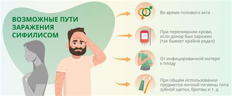 Профилактика сифилиса: важное знание для всех