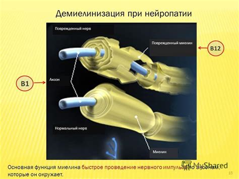 Раздражение нервных окончаний - основная причина боли при чихании