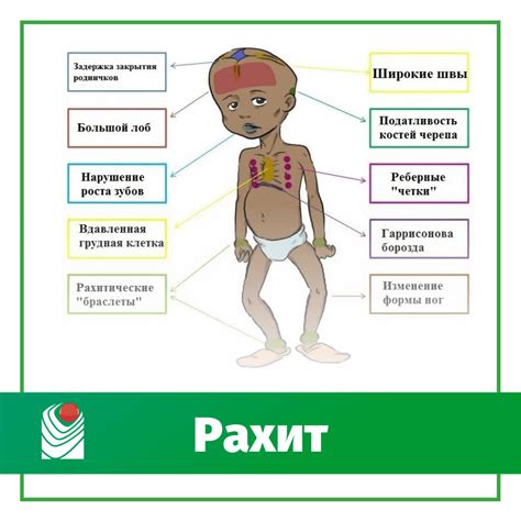 Рахит и наследственность