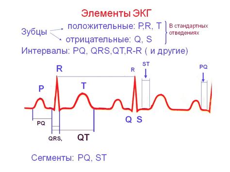 Результаты ЭКГ: что это такое?