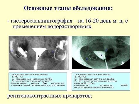 Рентген маточных труб: условия и приготовление