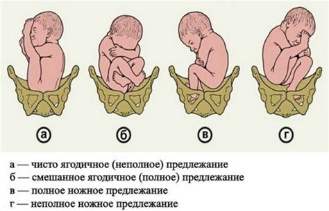 Роль опускания плода в процессе родов