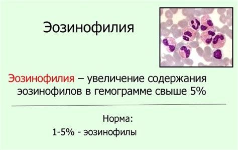 Связь повышенных эозинофилов с простудой