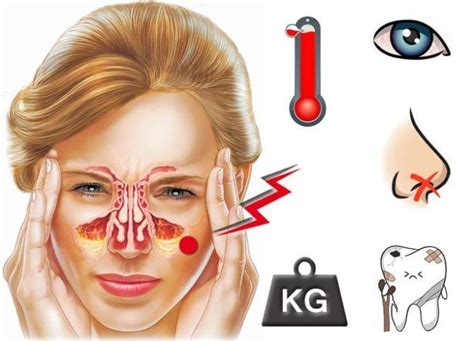 Симптомы болей в пазухах