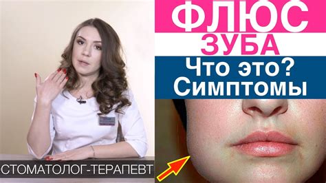 Симптомы и осложнения флюса