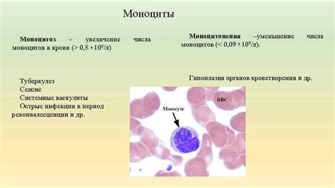 Симптомы низкого количества лимфоцитов и повышенного количества моноцитов