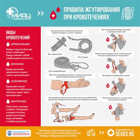 Советы для снятия дискомфорта при кровотечении