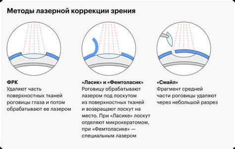 Стоимость лазерной коррекции зрения: факторы, влияющие на цену