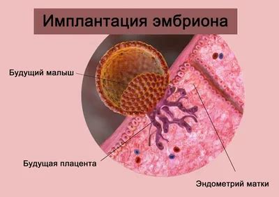 Сухожильная патология эмбриона