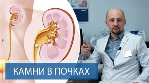 Тепловая процедура как дополнительное лечение камней в почках