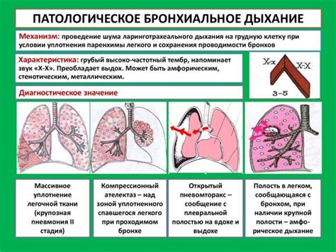 Типы пневмонии и длительность заболевания