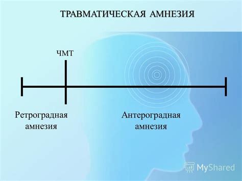 Травматическая амнезия