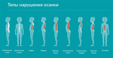 Физический дискомфорт и частые нарушения осанки