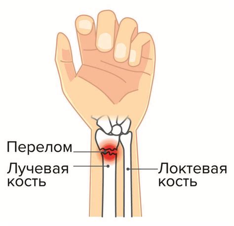 Хрустящие кости: причины и симптомы