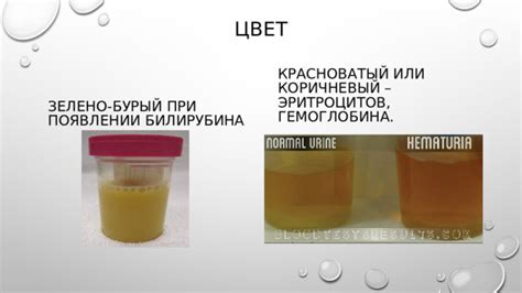 Цвет какашек при наличии билирубина: показатель здоровья