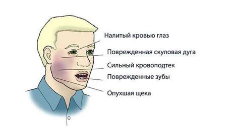 Что приготовить, если сломана челюсть