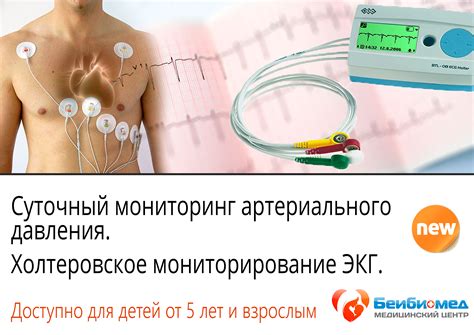 ЭКГ: методика проведения и значение данных