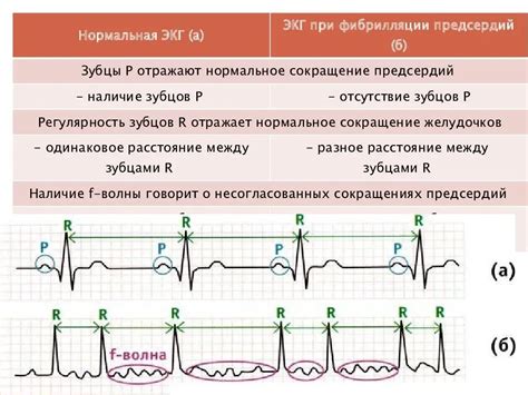 ЭКГ в оценке сердечной деятельности у пациентов с хроническими заболеваниями